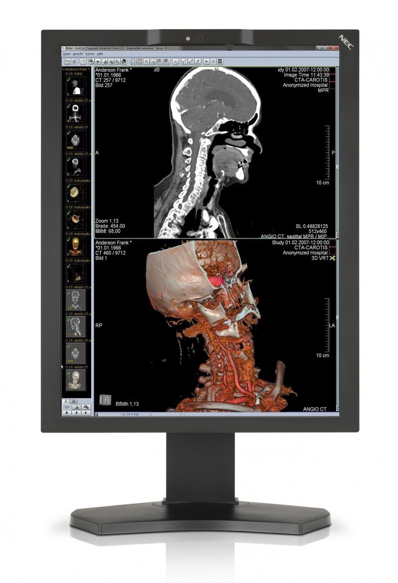 NEC MD210C2 - nowy model z serii diagnostycznych  monitorów medycznych