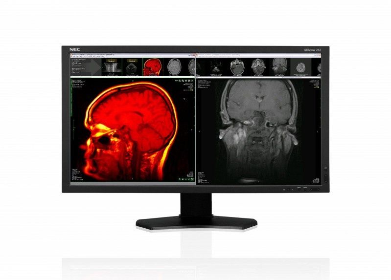 Nowy monitor medyczny NEC MDview243 z panelem IPS i podświetleniem LED